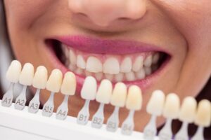 teeth colours Teeth colour comparison