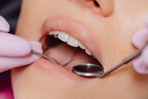 Hygienist teeth cleaning Alpine Dental Hygienist cleaning teeth